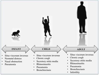 Primary Ciliary Dyskinesia: An Update on Clinical Aspects, Genetics, Diagnosis, and Future Treatment Strategies